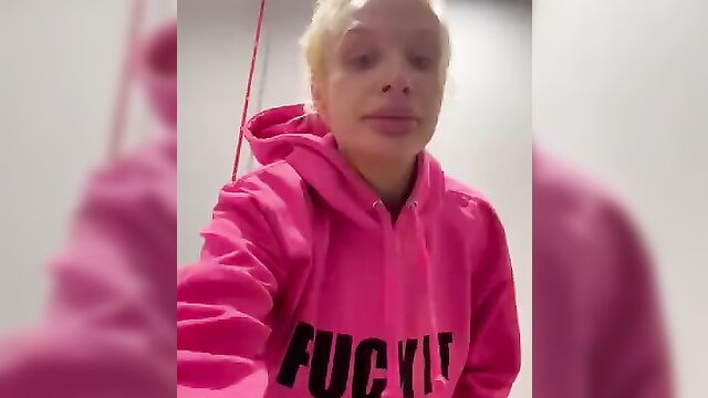 Model Sophie Anderson left with deflated breast after implant explodes - 1 image