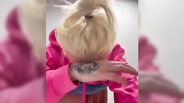 Model Sophie Anderson left with deflated breast after implant explodes - 4 image