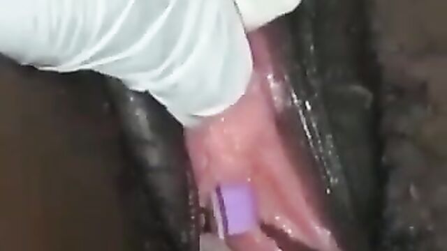 Doctors remove fake dildo from girl’s toto - 4 image