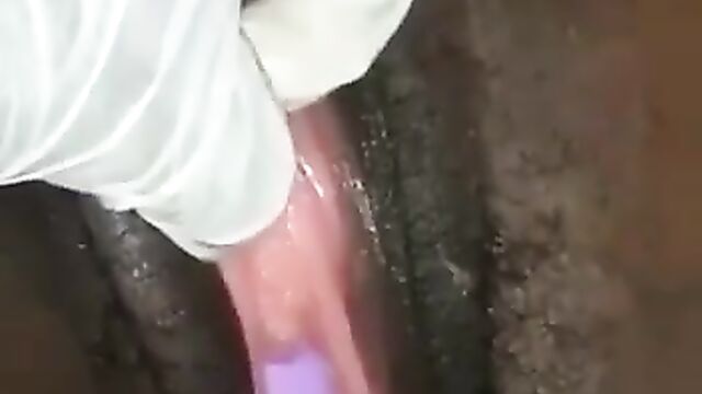 Doctors remove fake dildo from girl’s toto - 5 image