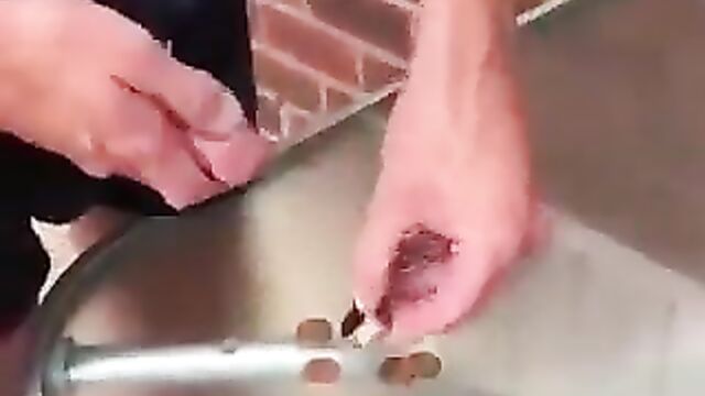 Man caught hiding money inside his penis! - 3 image