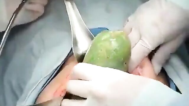 Doctors Remove Big Cucumber From Stomach Of Woman Caught Fucking Herself With Bottle And Cucumber - 4 image