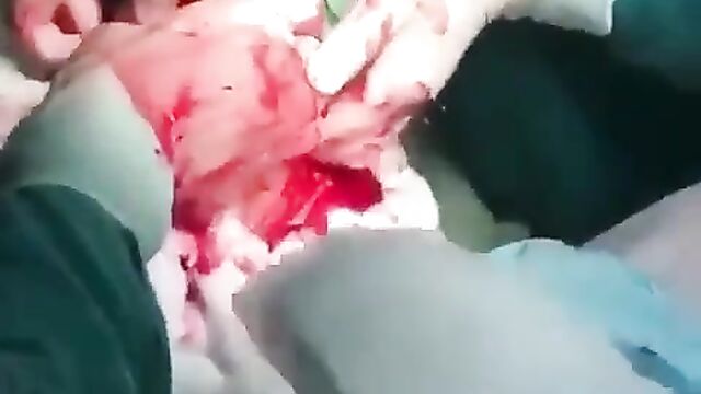 The Doctors Remove Dildo Sex Toy From Woman’s Stomach
