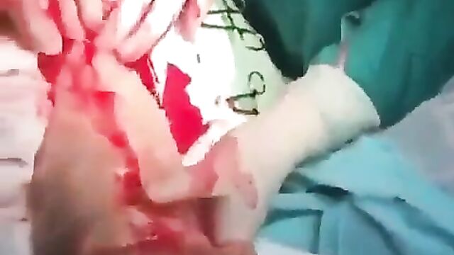 The Doctors Remove Dildo Sex Toy From Woman’s Stomach - 3 image