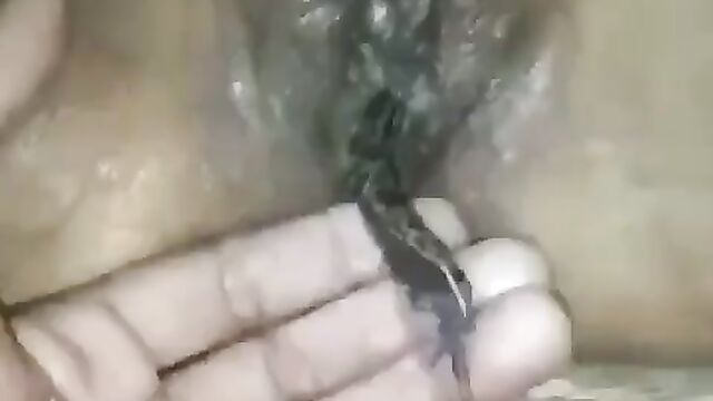 Frog in woman’s vagina - 1 image