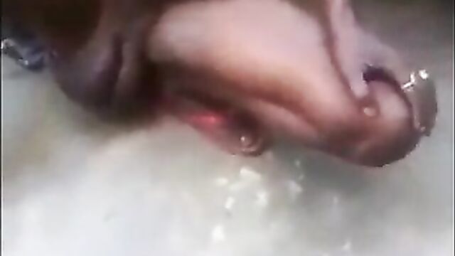 Strange sexual disease in Africa - 1 image
